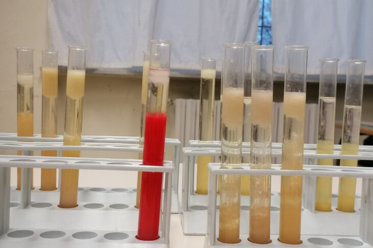 estrazione del dna